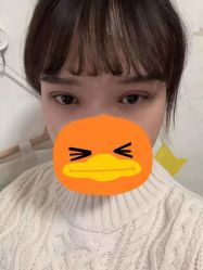 -成都西区医院整形美容