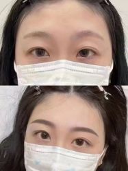 -张小野·专业半永久纹眉