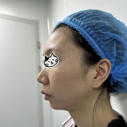 -杭州米兰柏羽医疗美容医院