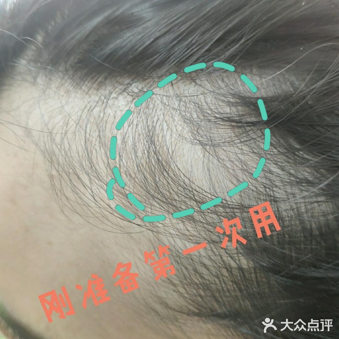 太好用了 谁说生发难的？站出来！ 