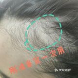 太好用了 谁说生发难的？站出来！ 