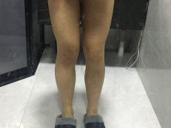 -温州伯思立医院