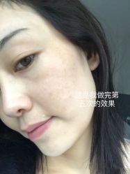 体验后-上海漾颜医疗美容