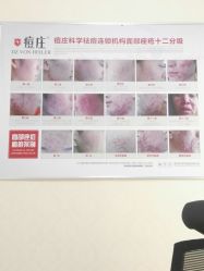 -痘庄科学祛痘国际连锁机构