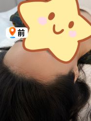 点击看大图 -原生美学·SMP3D纹发·纹野生眉