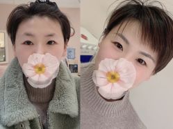 -UP&UP·半永久眉毛眼线机器野生眉