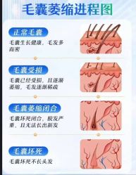 -Bollins波林丝•专研护发中心