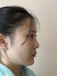 -北京米扬丽格医疗美容·联合丽格鼻整形中心