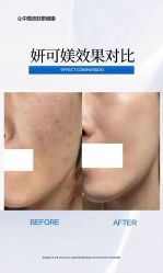 -SOS修丽可.痘肌修复中心