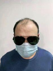 -发饰美男士增发补发假发定制店