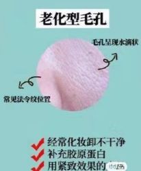 -凡碧诗毛孔清洁收细