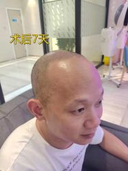 -雍禾植发全国连锁