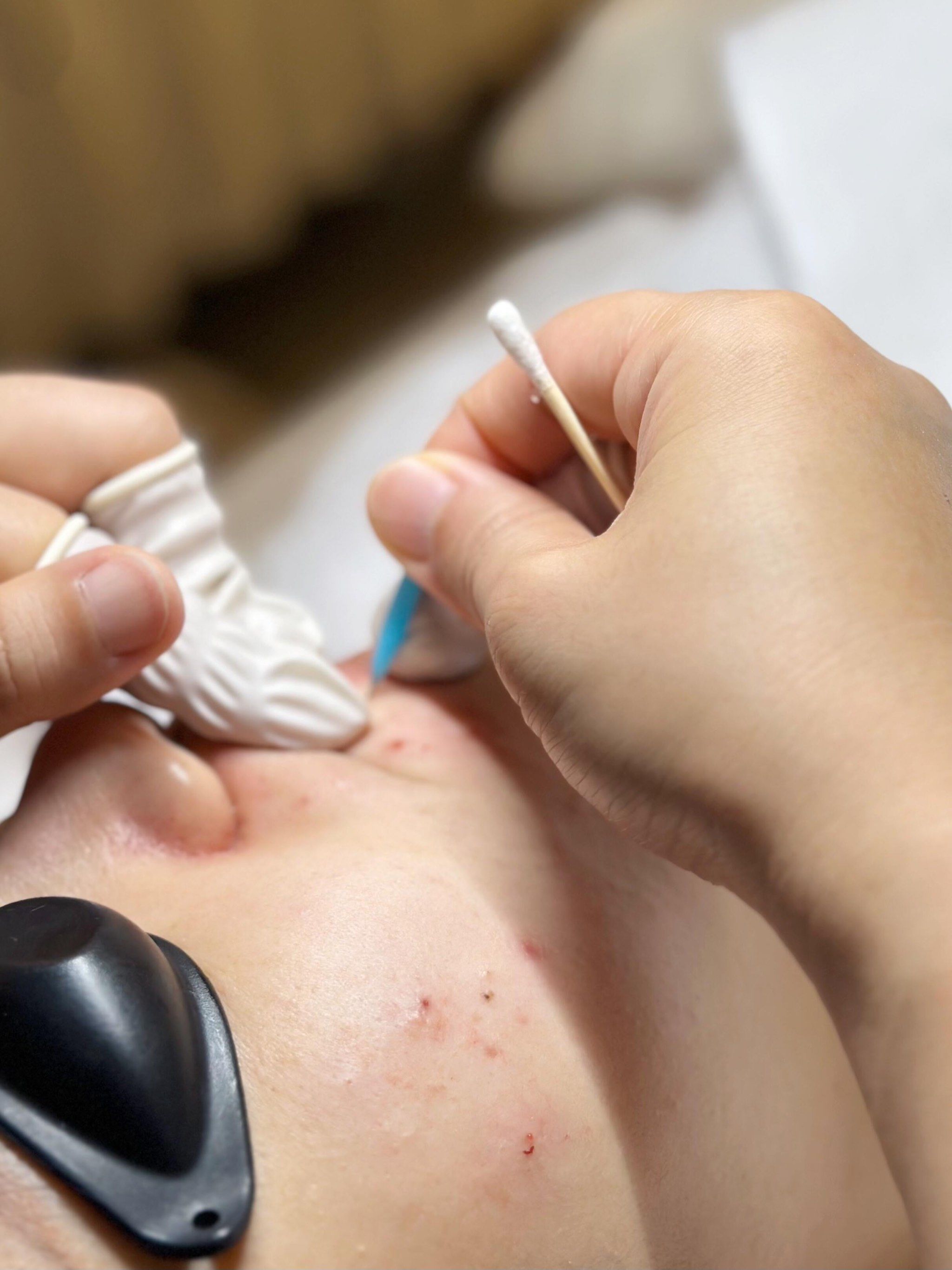 挤痘痘也能这么有趣!