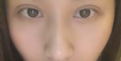 体验后-深圳广和门诊部·整形医疗美容