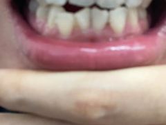 -微笑牙科口腔(三亚迎宾院区)