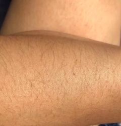 体验前-丽都整形美容医院·全国连锁旗舰店