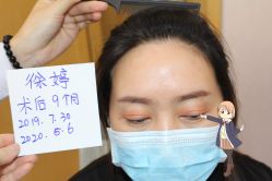 -大麦微针植发丨全国连锁