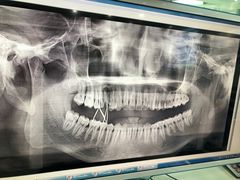 -众鑫医疗小白牙口腔(土桥店)