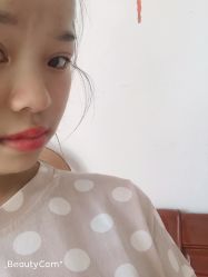 体验后-南昌艾莱芙美容医院