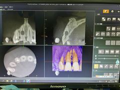 -爱贝口腔·牙周诊疗·种植修复中心