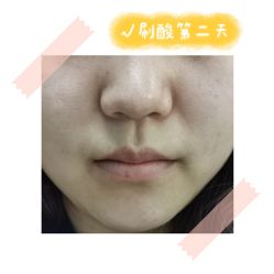 体验后-繁星轻医美连锁
