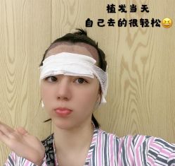 -碧莲盛·不剃发植发