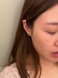 -四川米兰柏羽医学美容医院