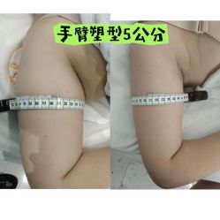 -Lily纤美·科技减脂中心