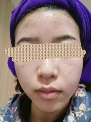 -安徽合肥韩美整形外科医院