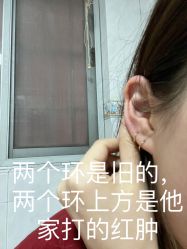 -花师傅专业手穿耳洞打耳洞穿孔