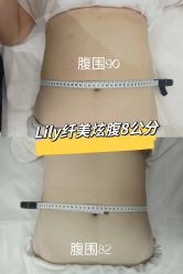 -Lily纤美·科技减脂中心