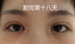 -JustHer宁波珈禾医疗美容医院