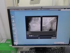 -上海仁爱医院口腔科 · 种植