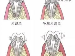 -团圆口腔·种植中心(锦江院区)