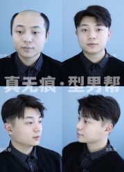 -型男帮男士假发补发·佩戴式发型
