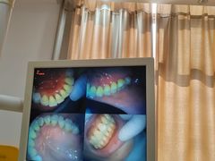 -赫尔森口腔·牙齿种植修复