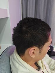 -雍禾植发