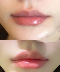 -郡艺医疗美容·微整·眼鼻吸脂