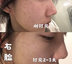 -铂诗玥医美
