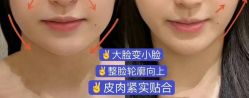 -安吉拉青春化管理中心