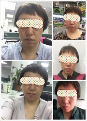 -皇族养心堂·净痘·修敏·御颜