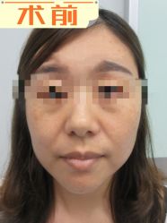 -素美医疗美容·西南眼鼻整形·修复基地
