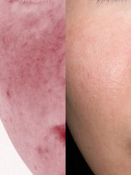 -深圳芙必优医疗美容·抗衰中心