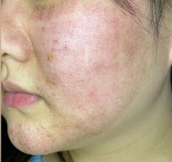 -上海漾颜医疗美容