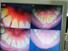 -土豆口腔(凤凰北总店)