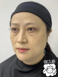 -广州健丽·去眼袋医疗美容机构