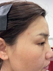 -北京美痣堂古方祛痣斑疣瘊
