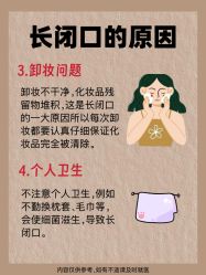 -克丽缇娜