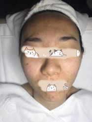 -皇族养心堂·净痘·修敏·御颜