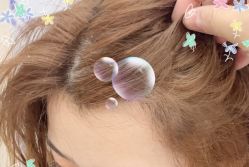 -大麦微针植发全国连锁